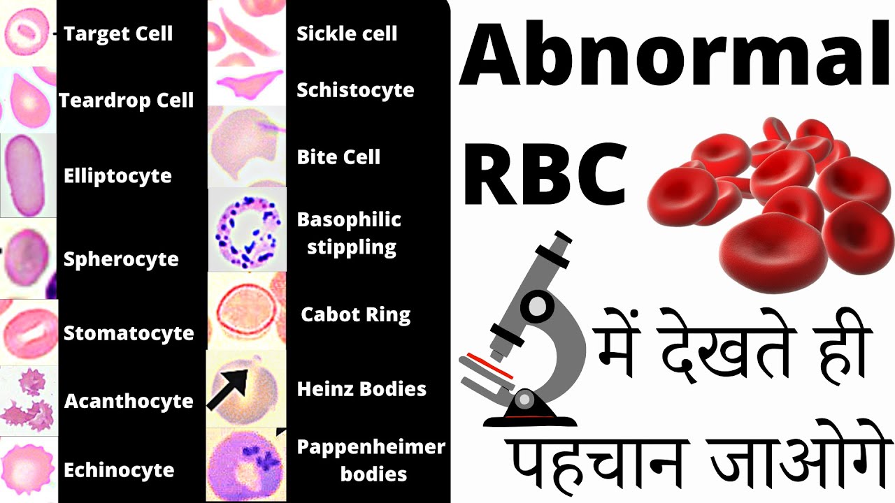 RBC Anomalies | RBC Abnormal Morphology | Inclusion bodies under microscope 🔬