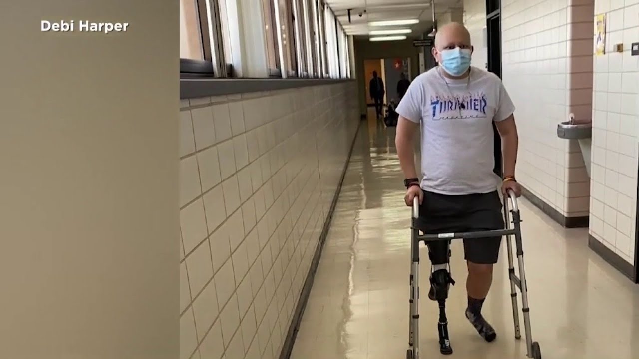 San Antonio teen battling rare bone cancer receives prosthetic leg