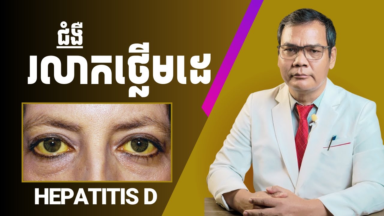 ជំងឺរលាកថ្លើមដេ/ Hepatitis D