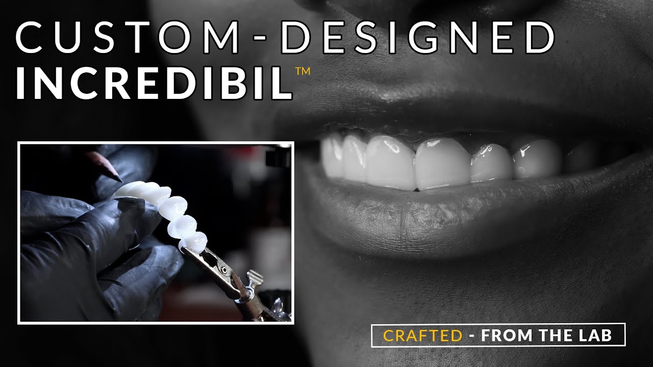 Stop being embarrassed to smile See how a smile changes appearance & confidence - Brighter Image Lab