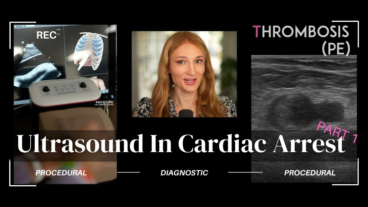Using Ultrasound to Manage Cardiac Arrest: A Practical Guide for Clinicians (Part 1)