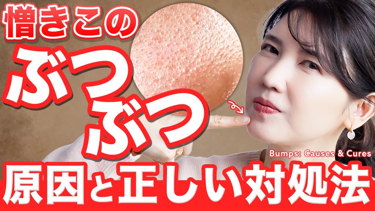 肌のぶつぶつ、それ『チキンスキン』。皮膚科医が正しい特徴と原因、スキンケア方法まで細かく解説します。