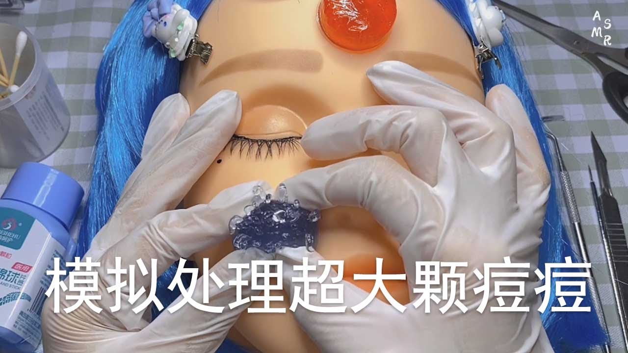 ASMR | 场景医院模拟处理超大颗痘痘 | 解压助眠【林一睡着辽】