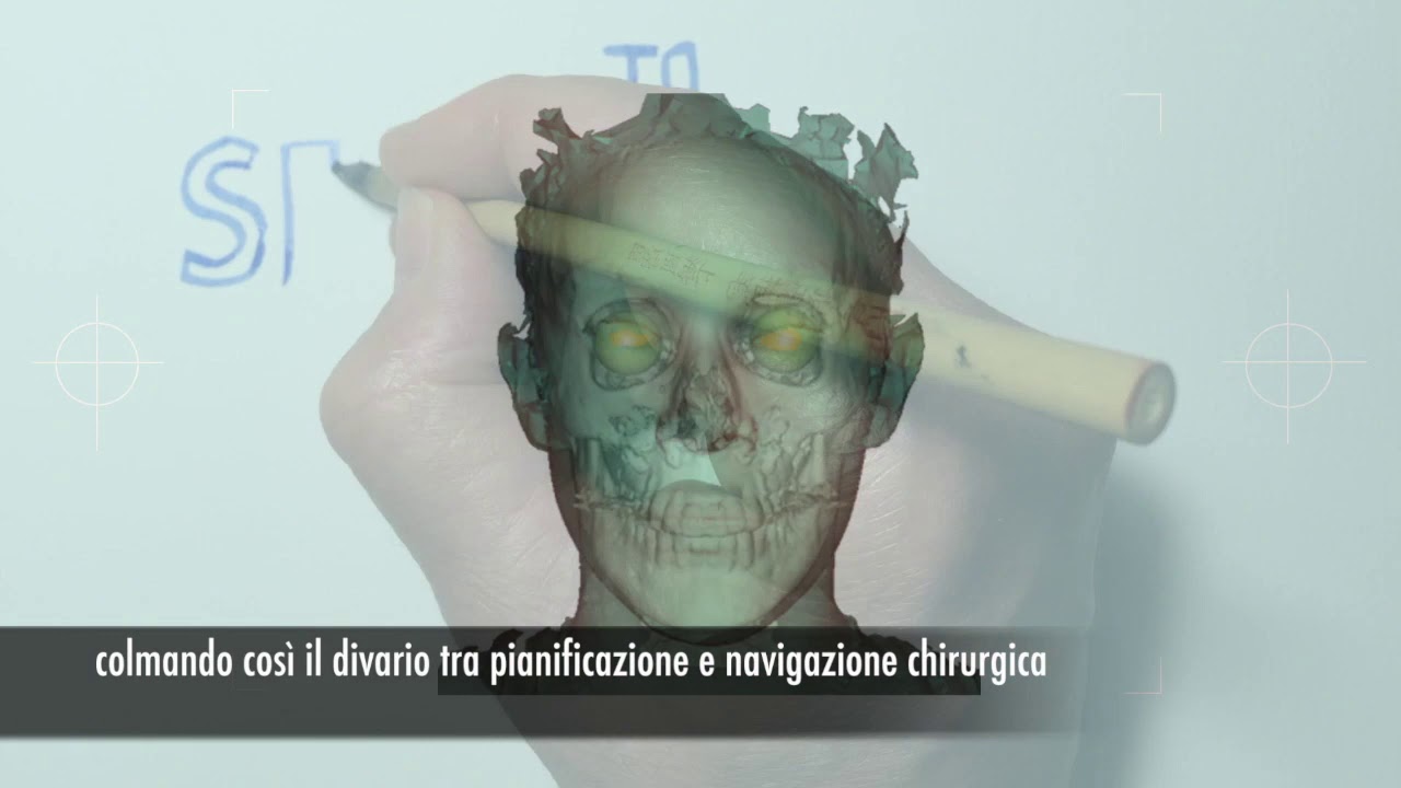 VOSTARS (Video and Optical See Through Augmented Reality Surgical Systems)