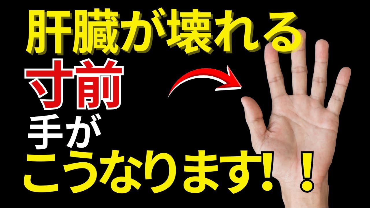【医師が警告】その膝の痛みを放置すると歩けなくなります｜9割が誤解する膝痛・関節ケア