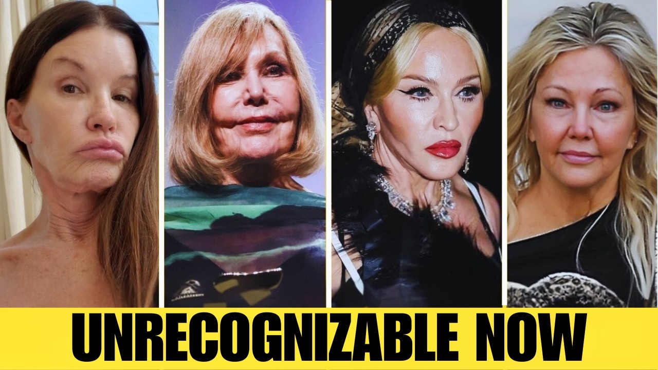 10 историй о пластических операциях знаменитостей, которые всех удивили | Тогда и сейчас, 2026