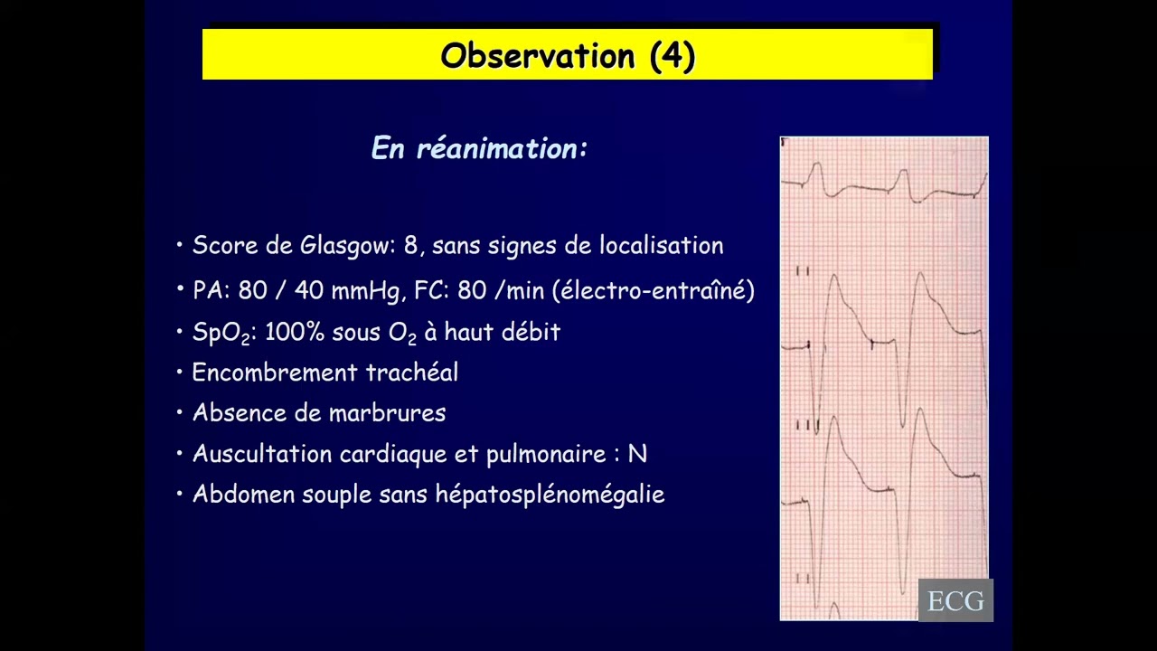 Module toxicologie - Intoxication aux cardiotropes
