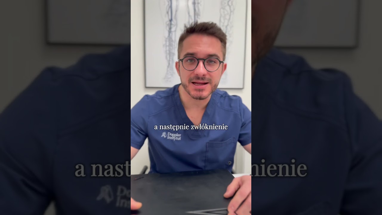 Stwardnienia po zabiegu skleroterapii #flebolog #flebologia #żylaki #skleroterapia