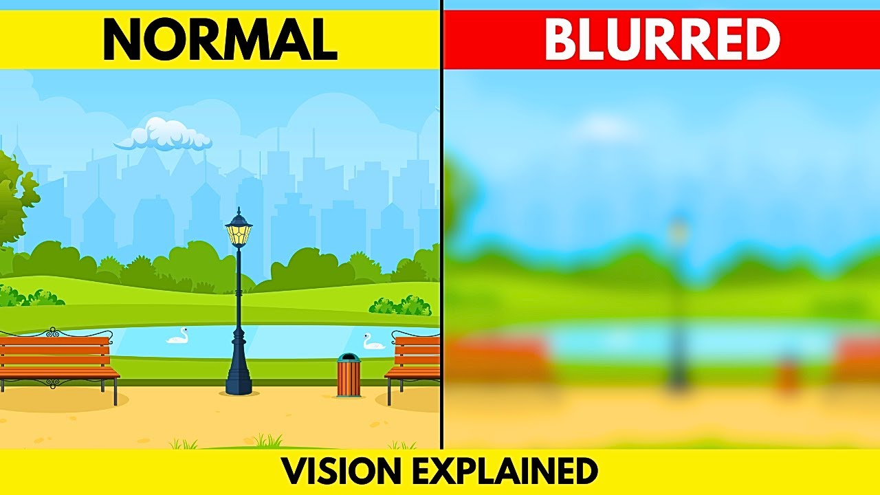 Why Is Your Vision Blurry? Blurred Vision Explained With Animations