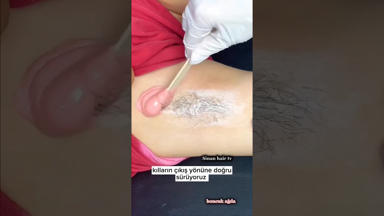KOLTUK altına boncuk  ağda yapımı !! Waxing Underarms short hair #waxing #wax #armpit #benionecikar
