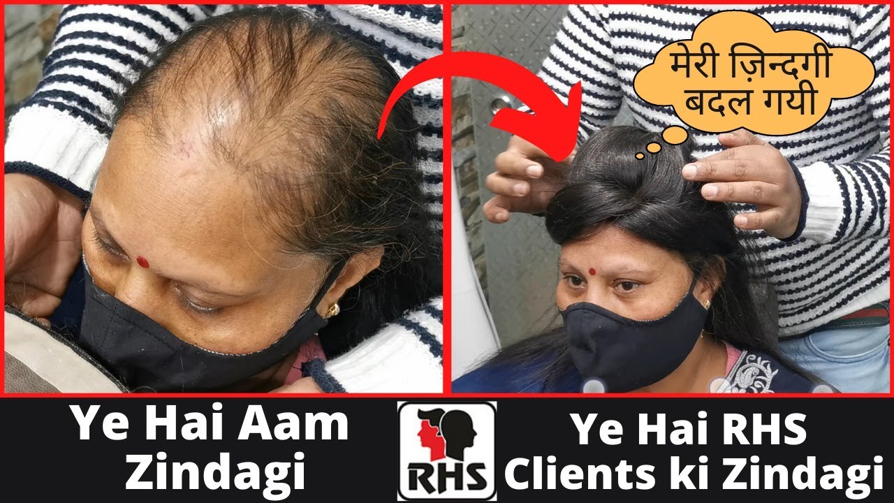Ladies Hair Wig | Full Hair Transformation | Hair Wigs for Women | Rizy Hair Solution