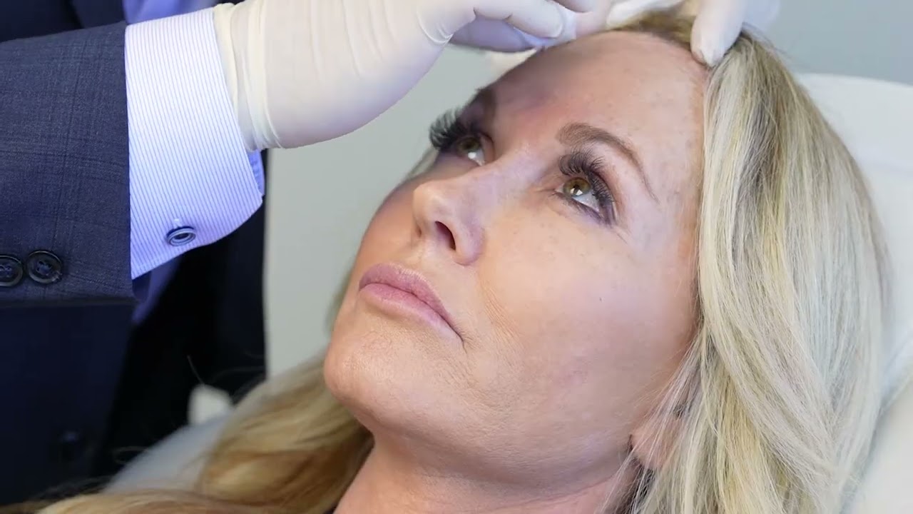 Botox in Newport Beach with Plastic Surgeon Dr. Gaon