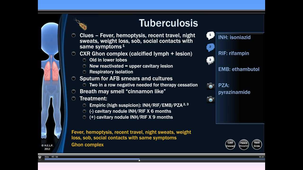 PANCE PANRE Tuberculosis review