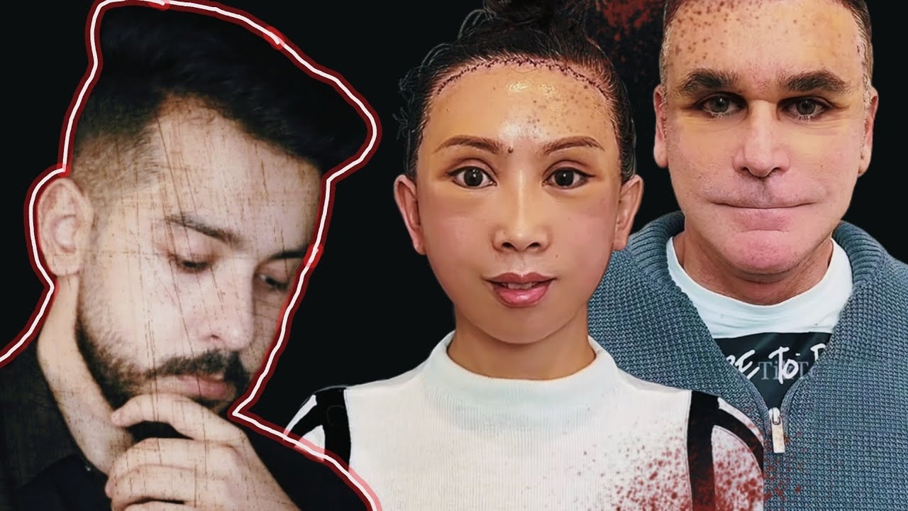 دكتور كيم...اغرب طبيب تجميل على تيك توك💉😨
