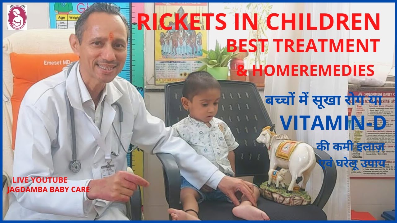 RICKETS IN CHILDREN BEST TREATMENT & HOMEREMEDIES,बच्चों में सूखा रोग VITAMIN -D की कमी इलाज़ नुस्खे