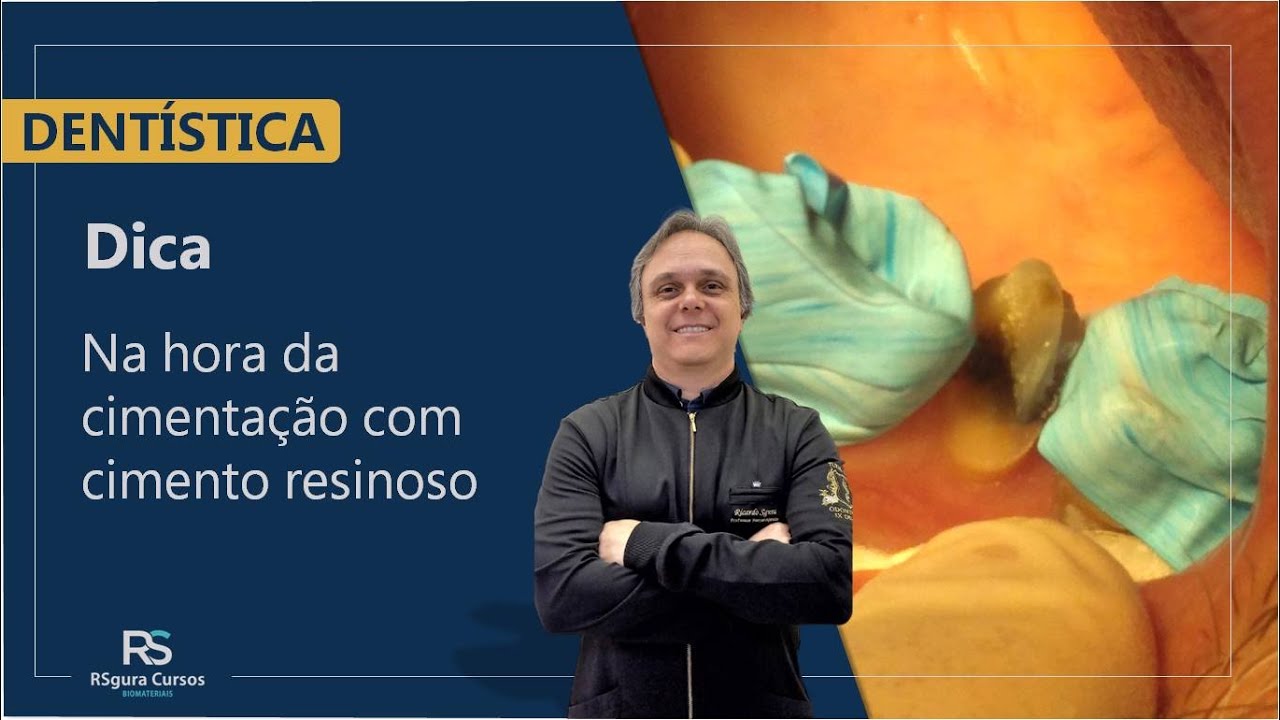 Dica para cimenta&ccedil;&atilde;o com cimento resinoso