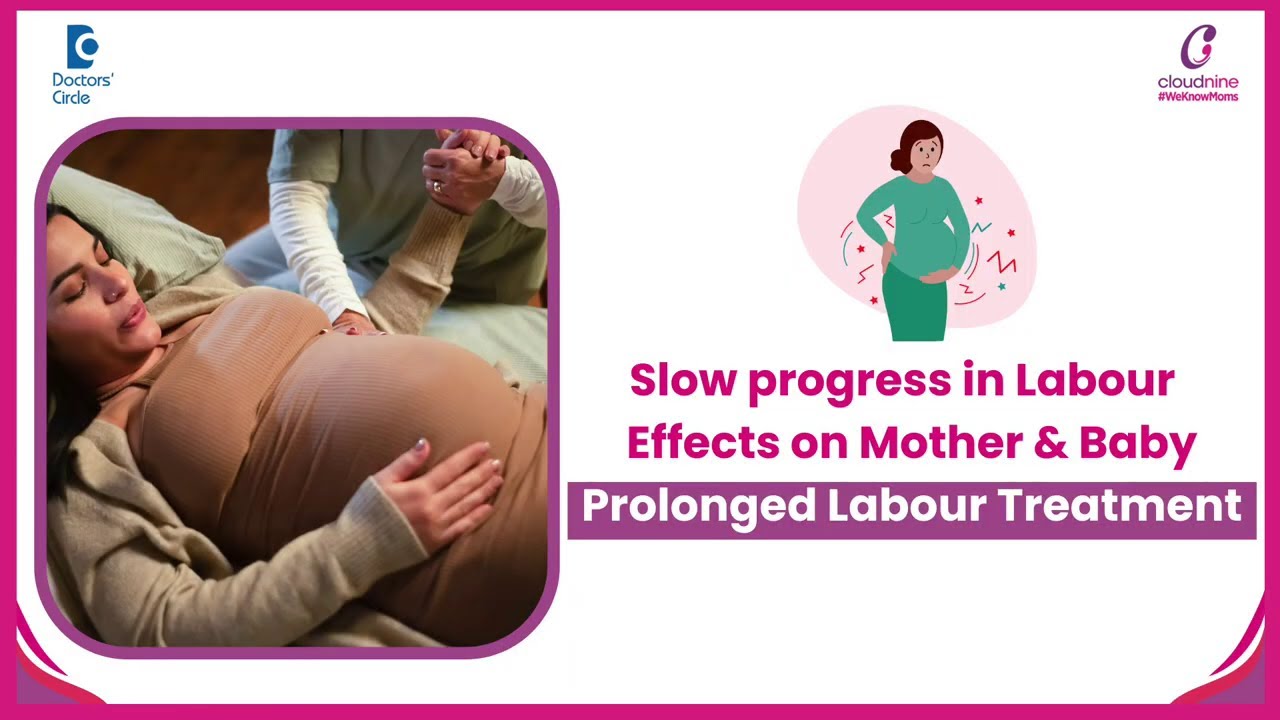 Meaning of Slow progress in labor?-Dr. Nandyala R Padmapriya at Cloudnine Hospitals |Doctors' Circle