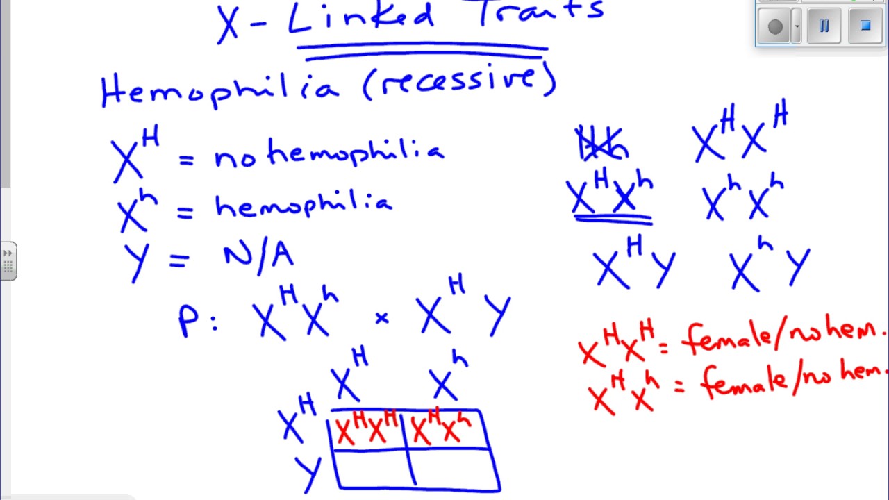 X Linked Inheritance