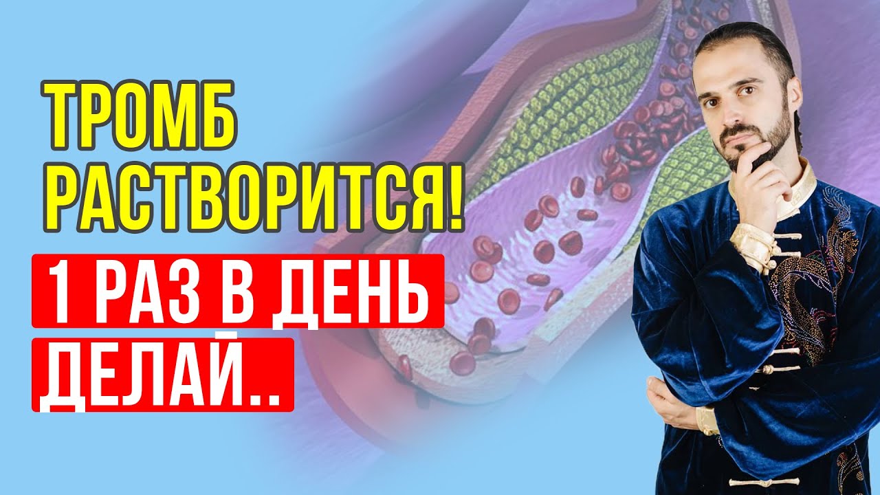 Как избавиться от тромба за 2 недели? Как растворить образовавшийся тромб? Упражнения Цигун