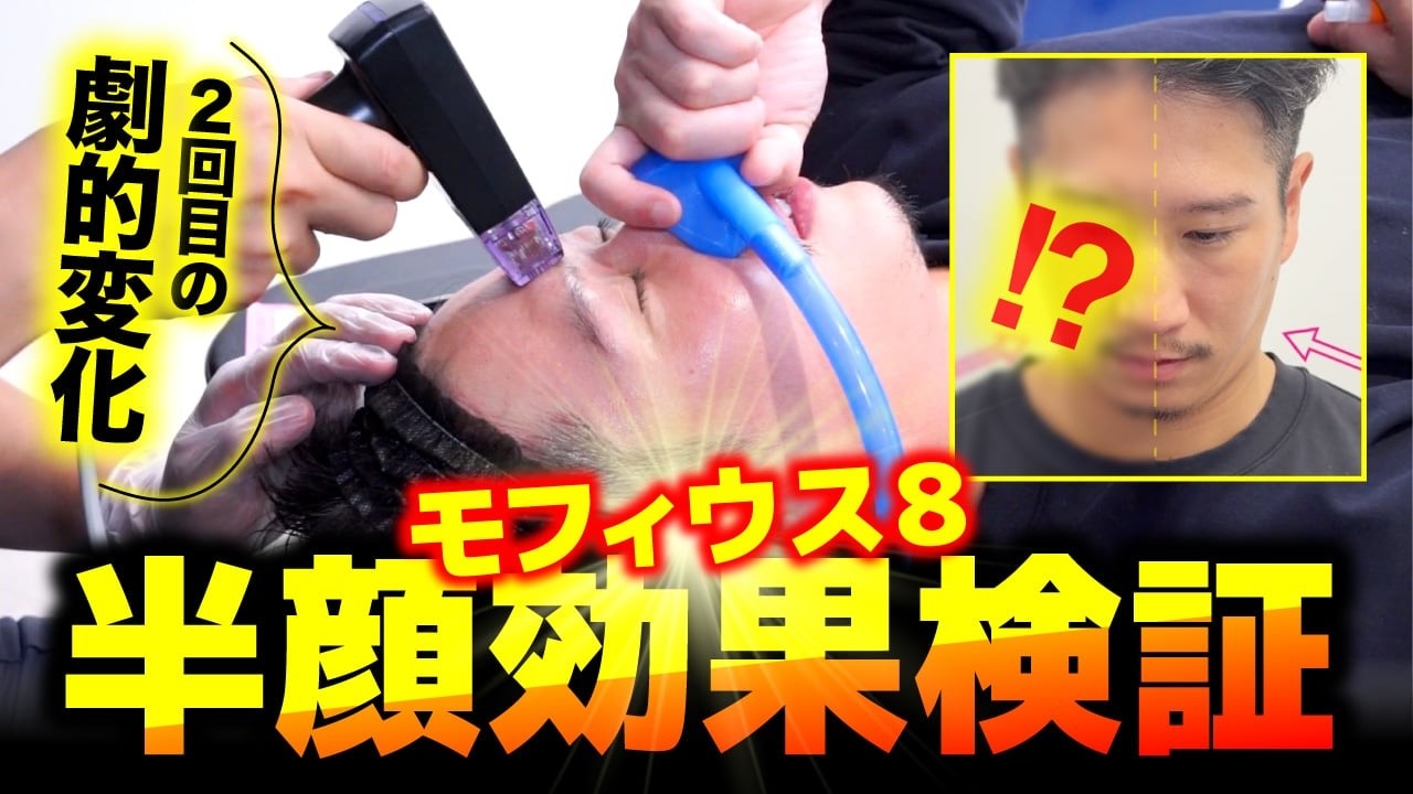 【半顔検証】モフィウス８半顔実験してみた結果...