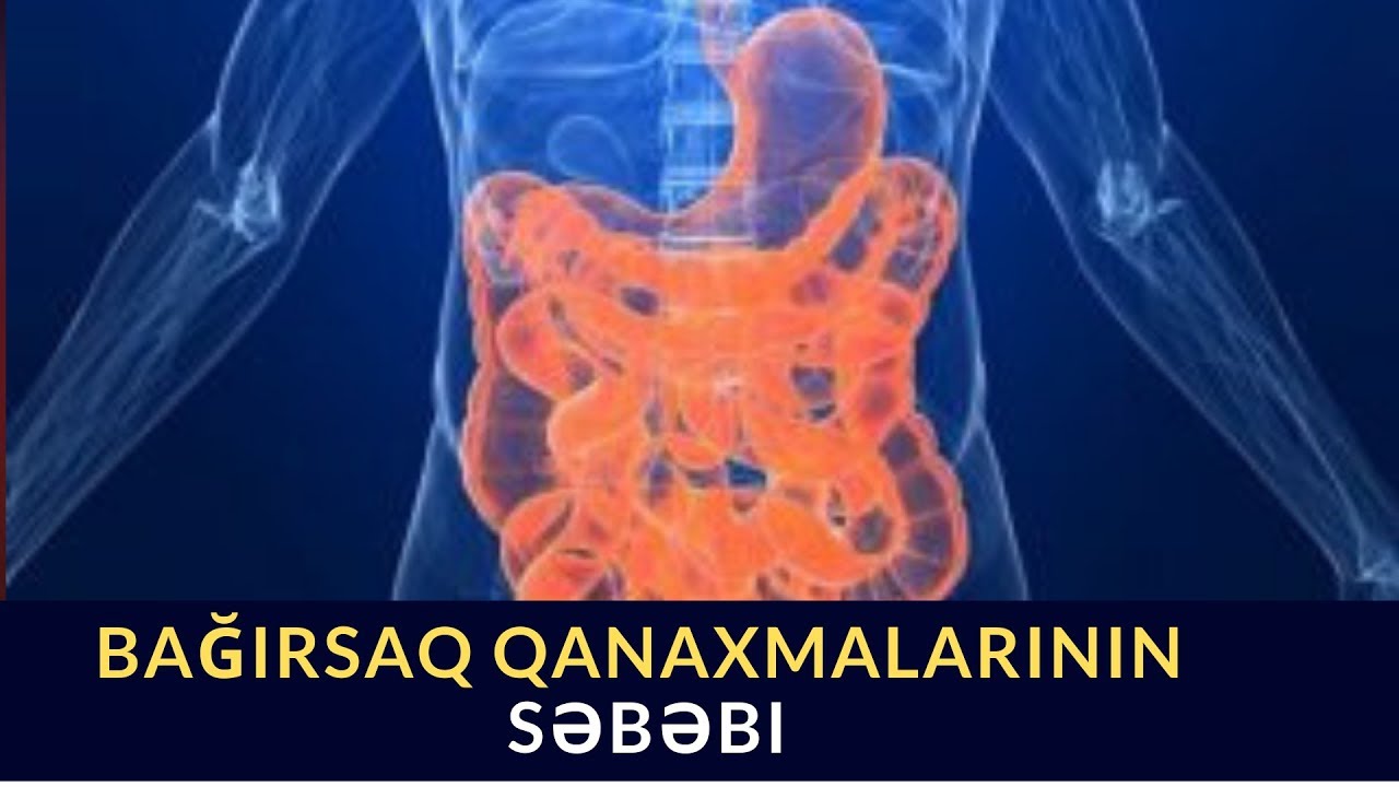Nəcisdə qan varsa  bu xəstəliklərdən xəbər verir?