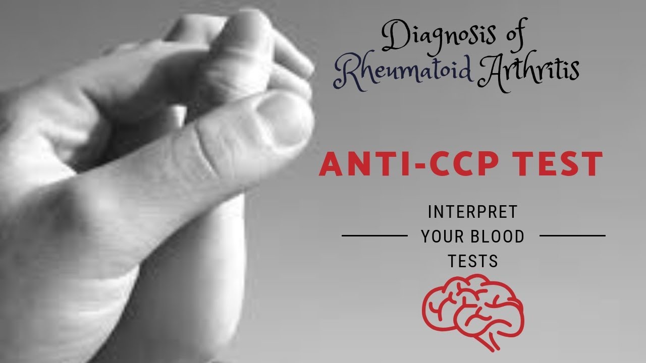 What is Anti CCP Test? Its Role is assessment of Rheumatoid Arthritis ; Normal Levels : Dr Kasi MD