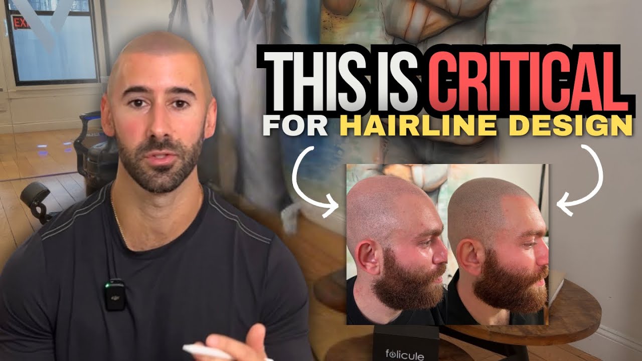 This is CRITICAL for Hairline Design
