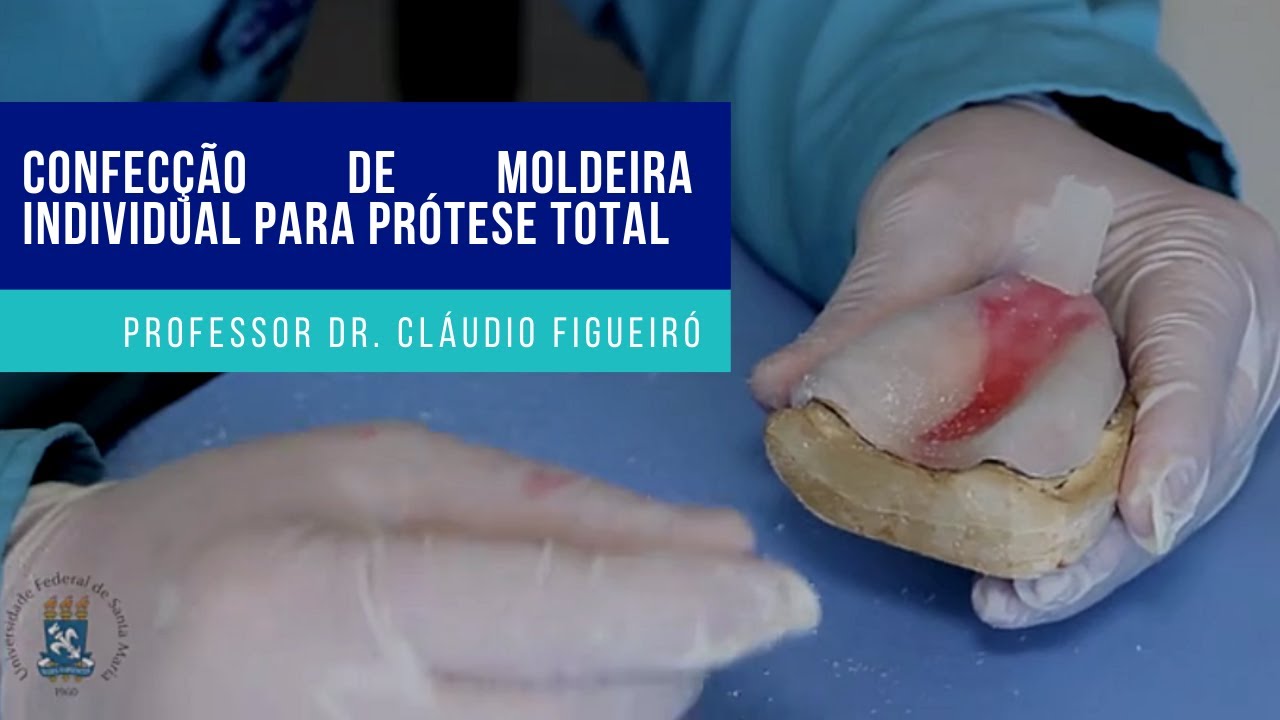 CONFEC&Ccedil;&Atilde;O DE MOLDEIRA INDIVIDUAL PARA PR&Oacute;TESE TOTAL