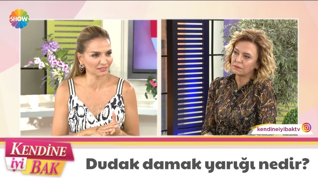 Dudak damak yarığı nedir?