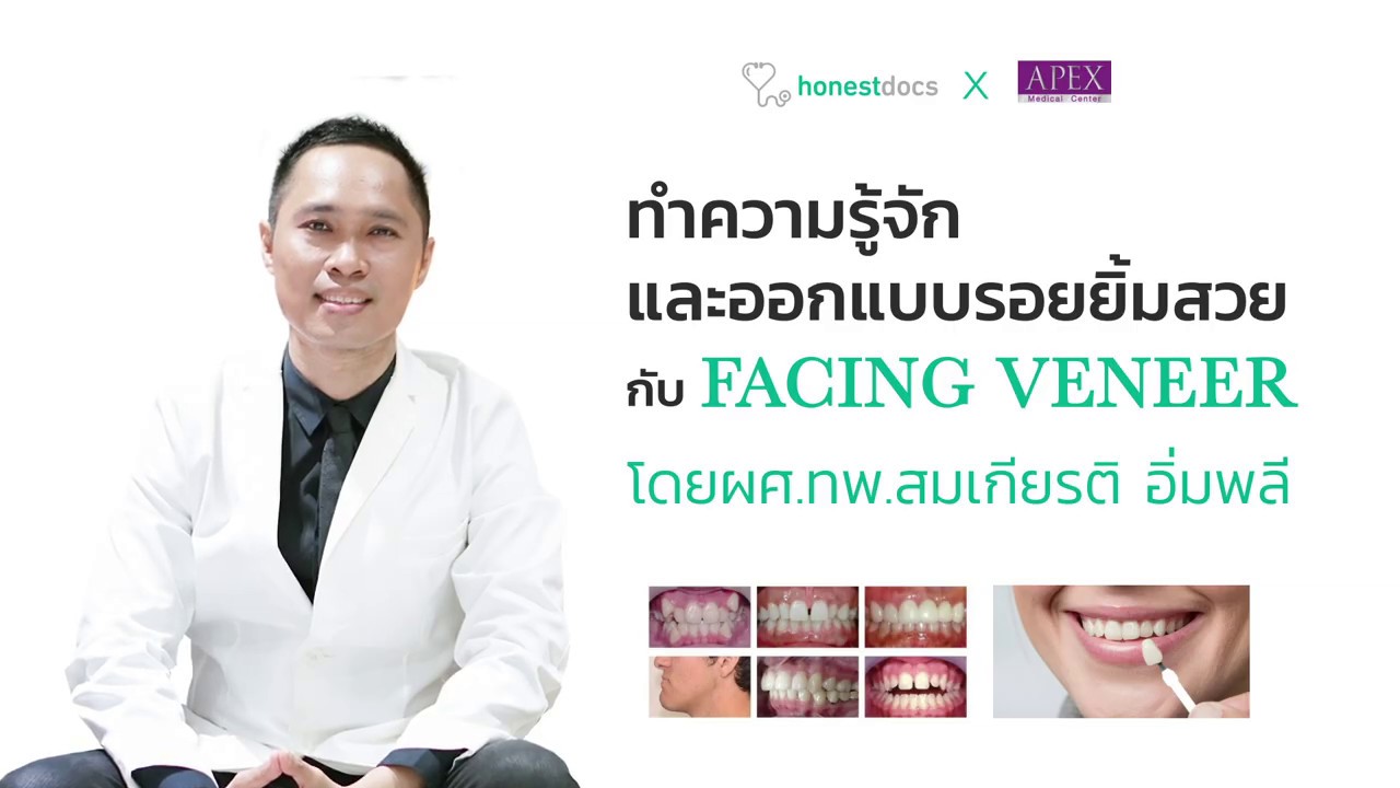 วีเนียร์คืออะไร?  ข้อควรรู้ก่อนทำ Veneer?  ตอบทุกคำถามโดยทันตแพทย์ | HDmall.co.th