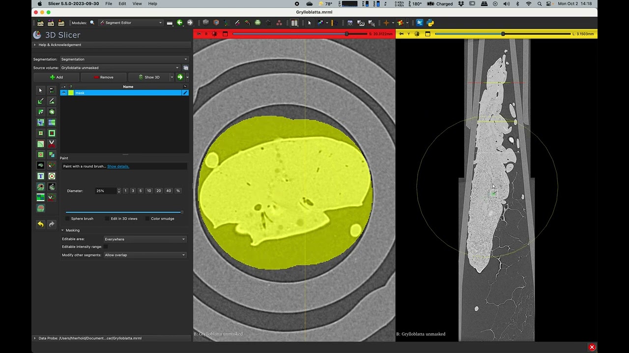 02 Masking with Fill between Slices