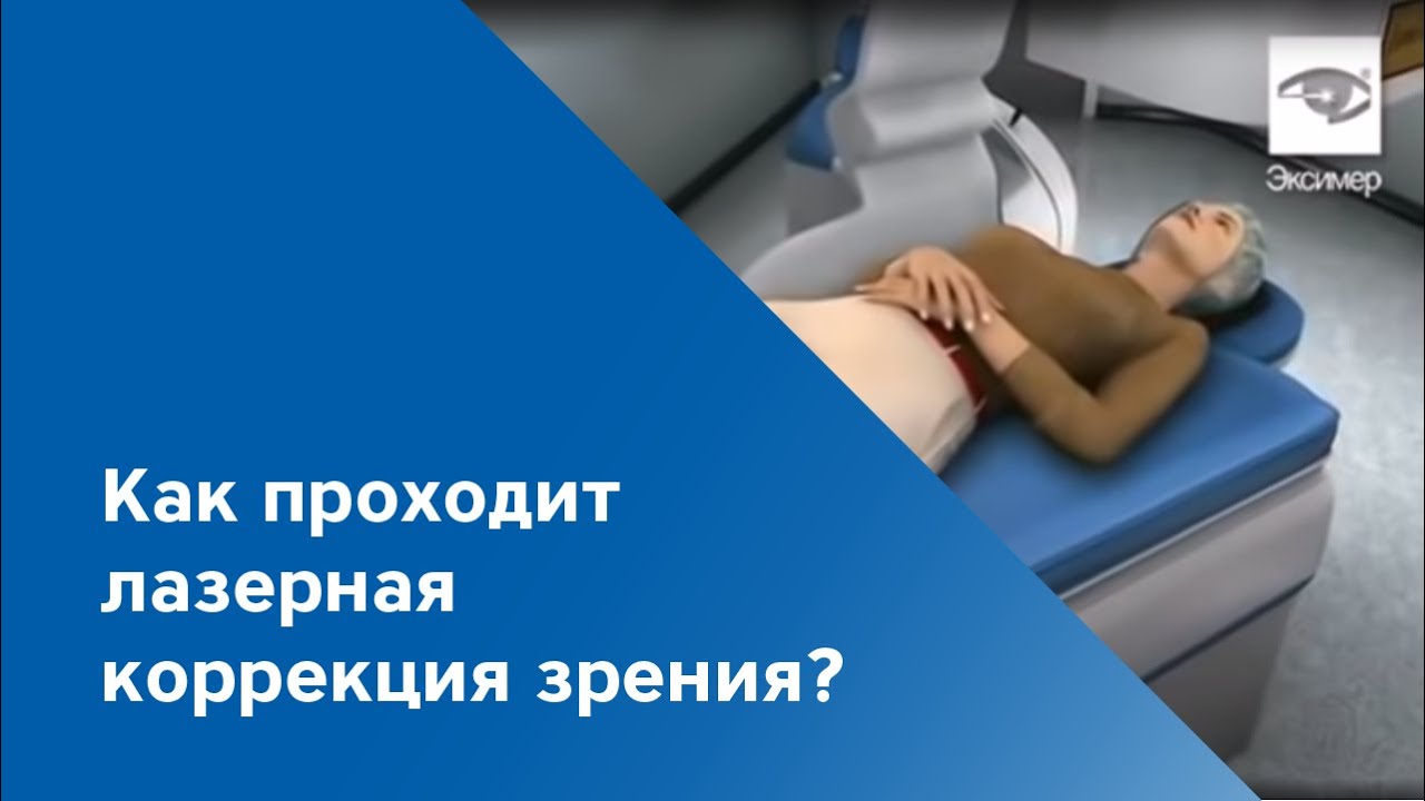 Как проходит лазерная коррекция зрения? | Клиника &laquo;Эксимер&raquo;