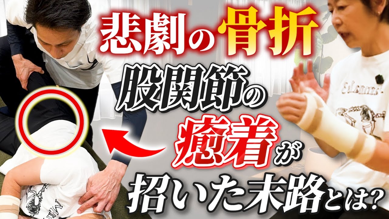 【ぐらぐら】思うように動かない足のせいで転倒→骨折…。股関節の違和感が招いた悲劇。
