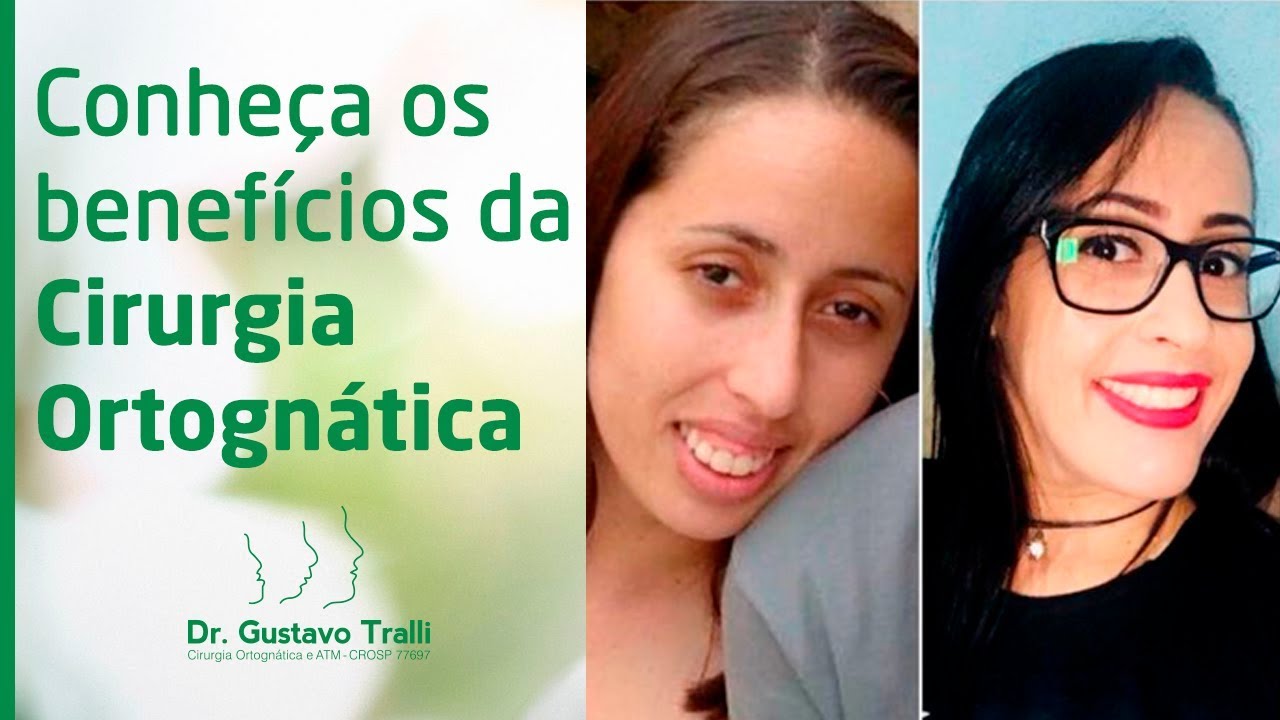 Cirurgia Ortognática - Procedimento Transforma Vida de Paciente