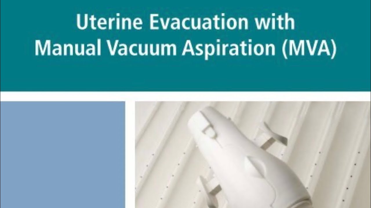 MANNUAL VACUUM ASPIRATION MVA @CaseDiscussionsMRCOG-DrShabana