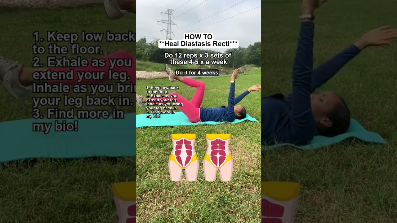 HEAL your diastasis recti NATURALLY with these exercises! 💪
