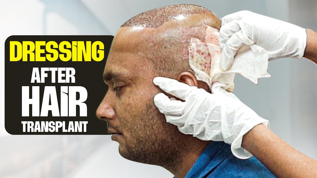 Dressing After Hair Transplant: Step-by-Step Instructions 👨🏻‍⚕️ | New Roots