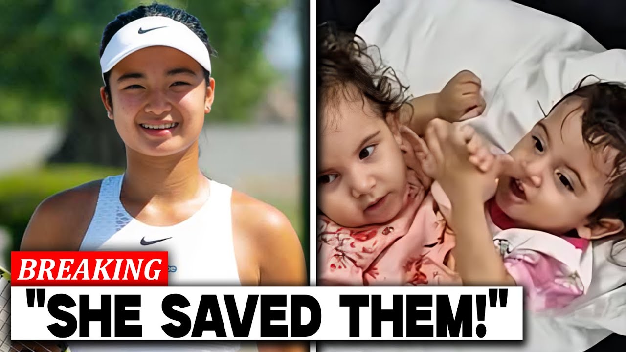 MIRACLE Save Conjoined Twins Before Venus Williams Match