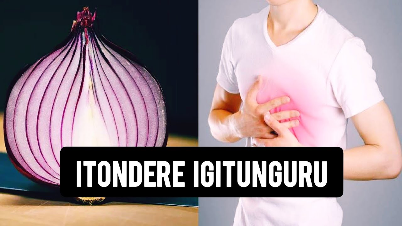 Itonde cyaguhitana| igitunguru| igitunguru akamaro| igitunguru gitukura| igitunguru mu musatsi|ibibi