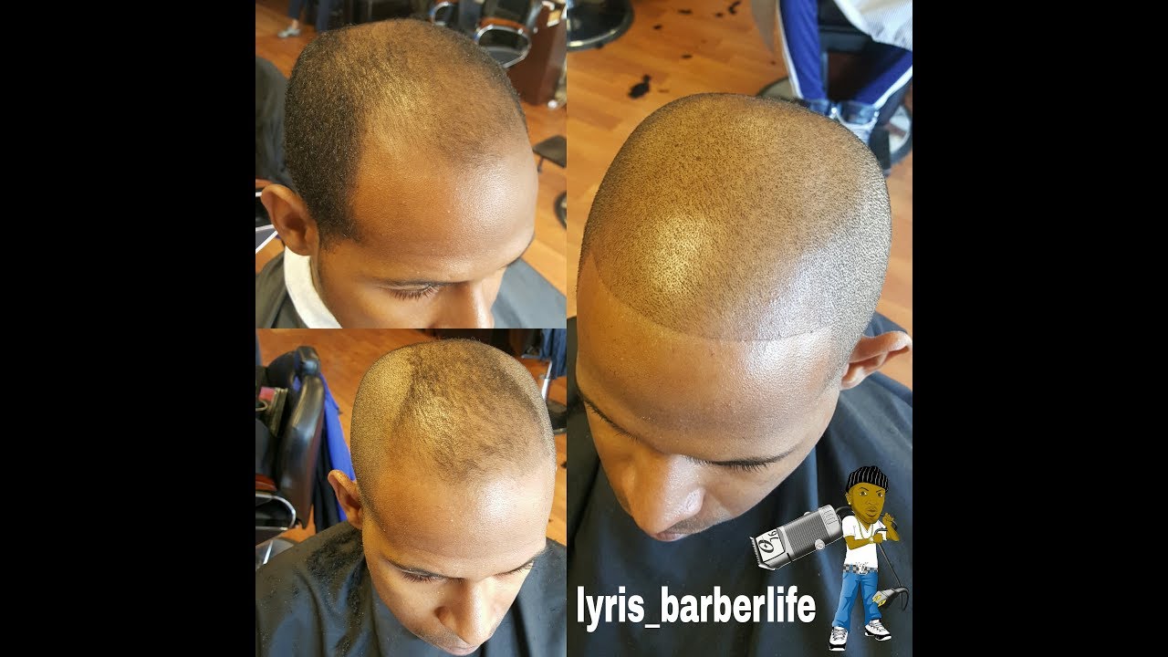 Barber techniques on BLENDING  BALDING THIN HAIR.. INSTAGRAM: lyris_the_artist