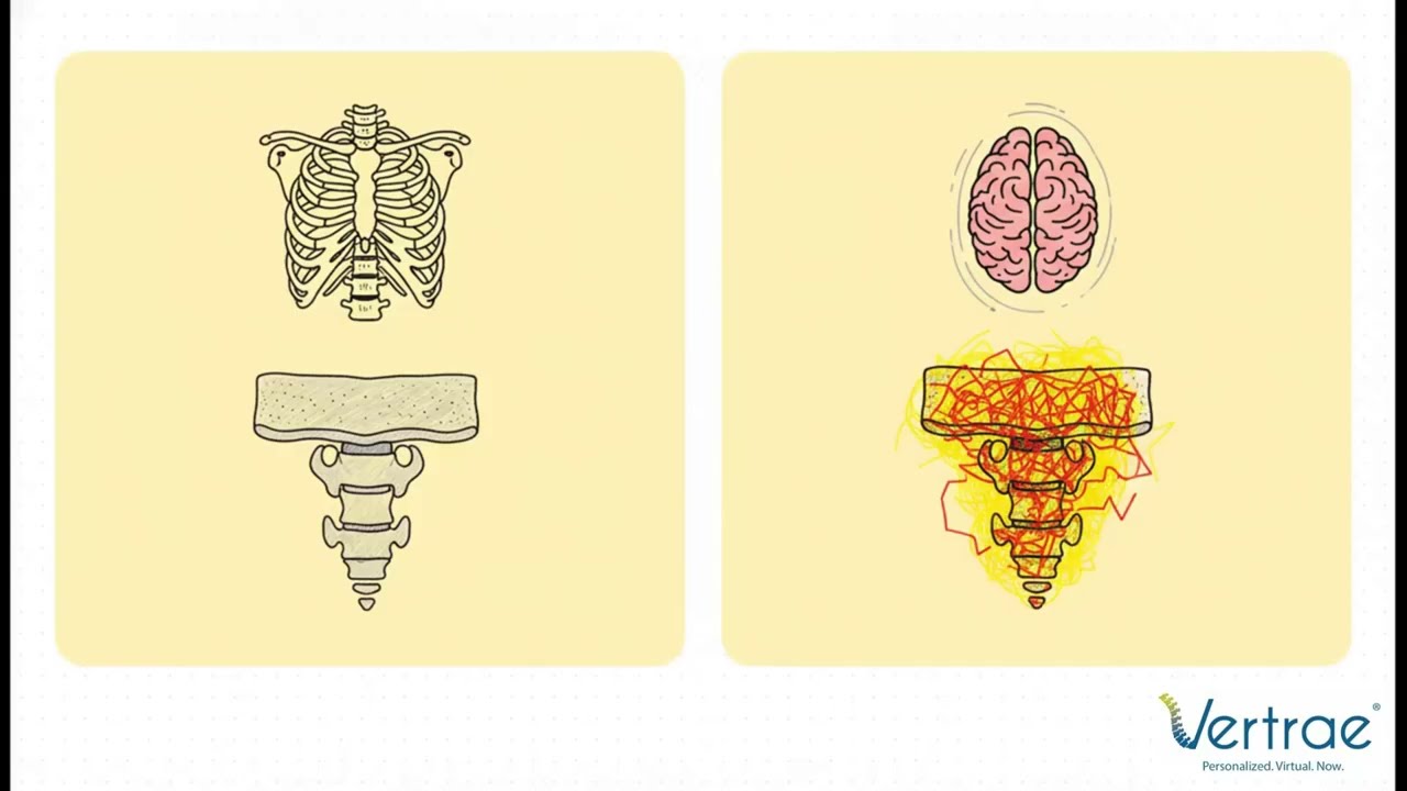 How Doctors Know If Your Back Pain Is a Fracture | Dr. Kamal Woods | Vertrae&reg; Dayton