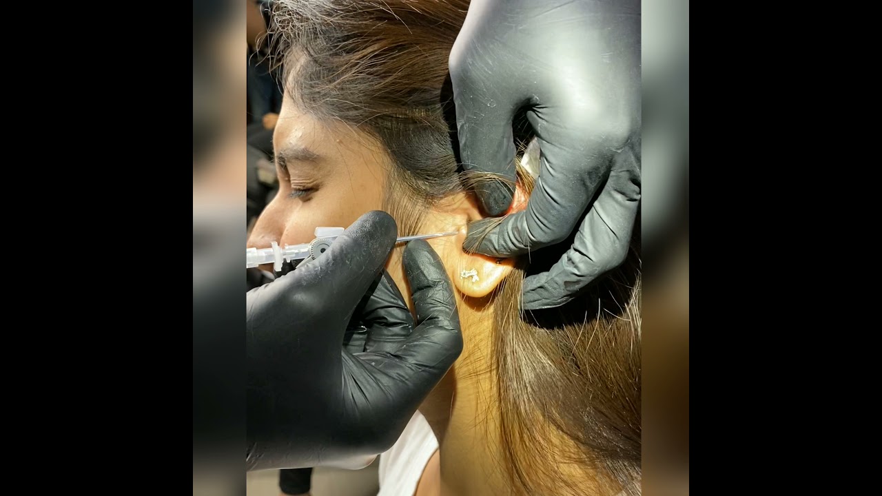 Tragus and Helix piercing with cannula and needle. Best piercing experience in vizag #piercing