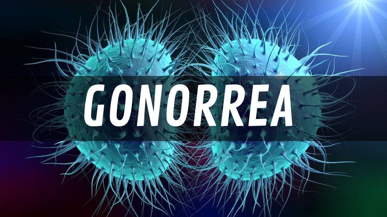 GONORREA - síntomas, diagnóstico, tratamiento y prevención
