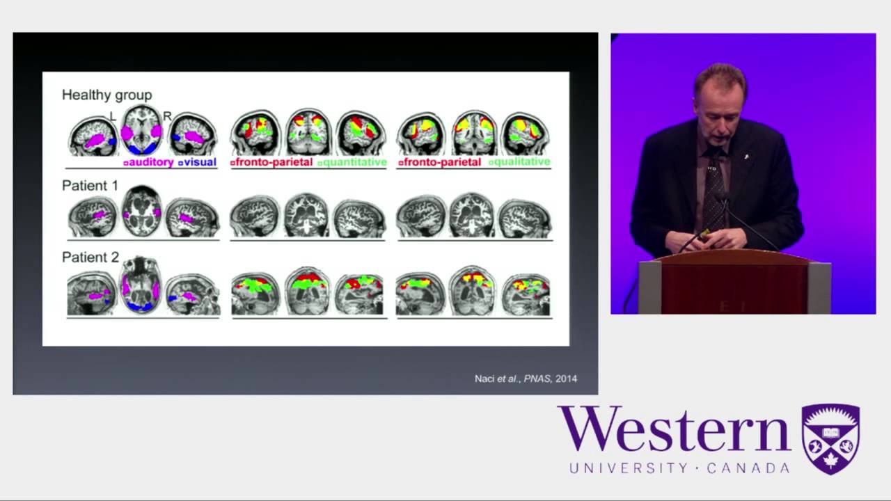 BNA2015 Public Lecture Adrian Owen