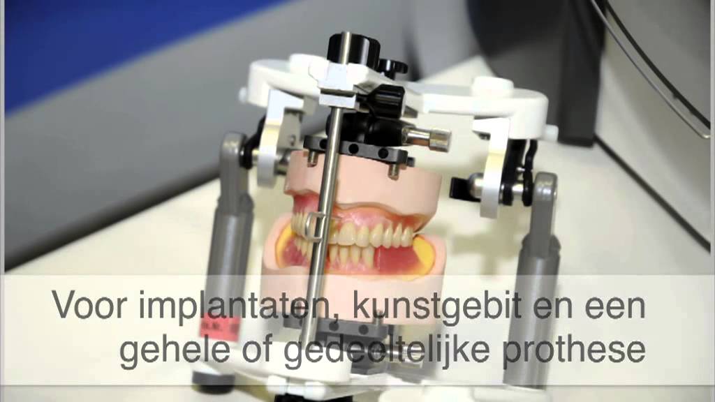 Kunstgebit - Heerlen Wladimir Schepers tandprotheticus
