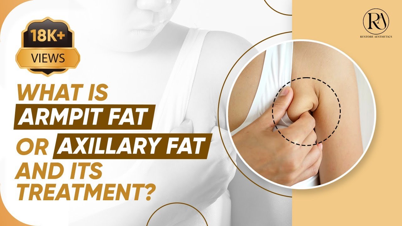 Armpit Fat Removal Surgery: Underarm Liposuction for Axillary Breast