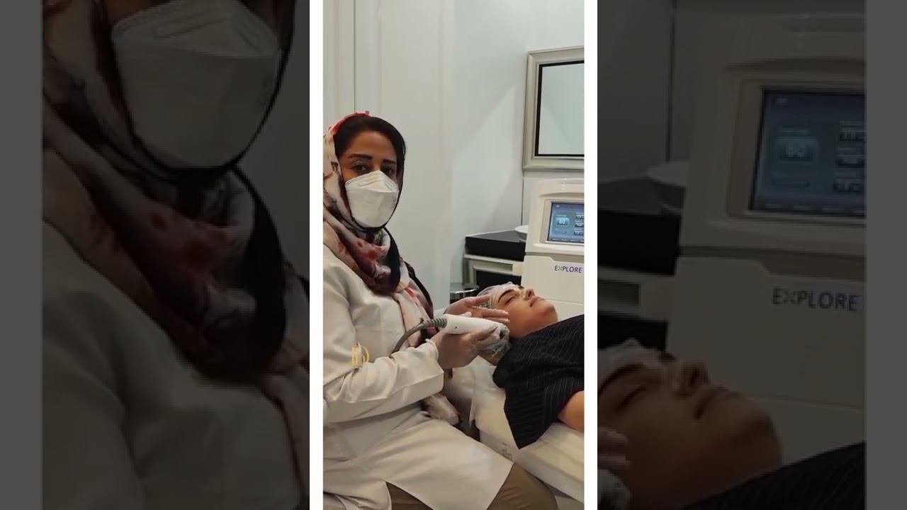 آر اف فرکشنال چه تأثیری روی پوست میگذارد
