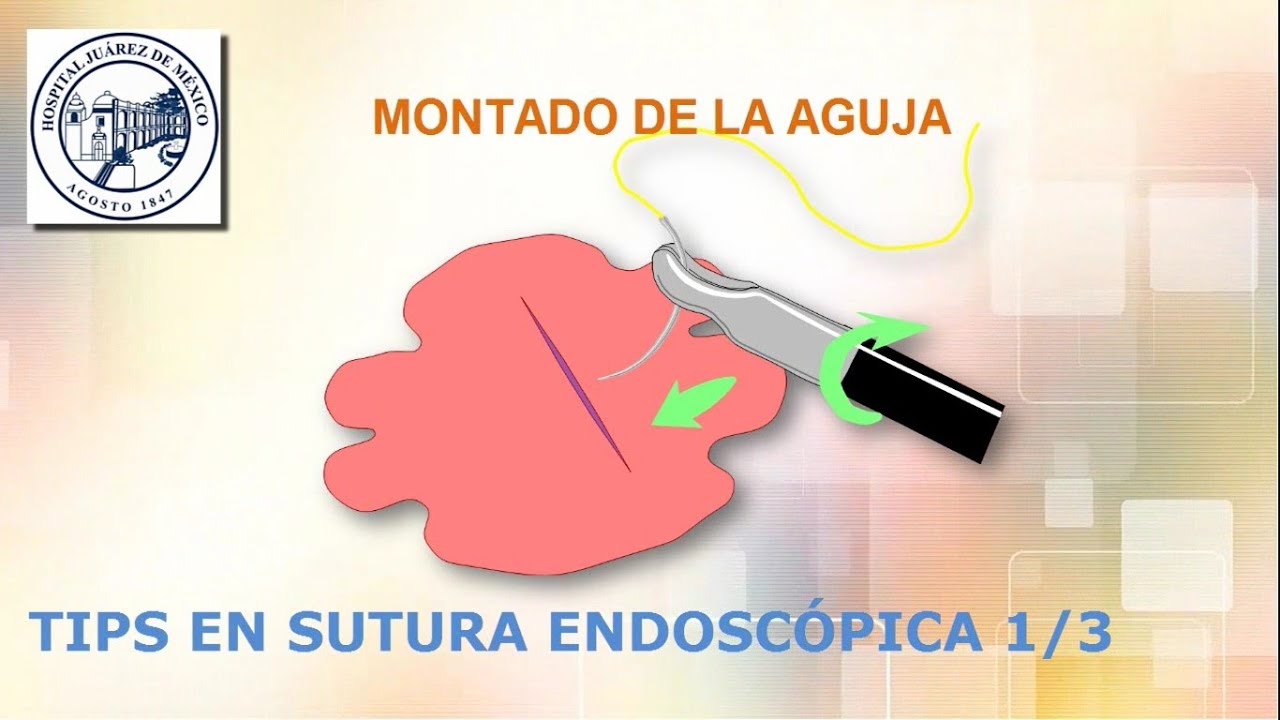 tips en sutura endoscópica 1/3 (montado de la aguja)