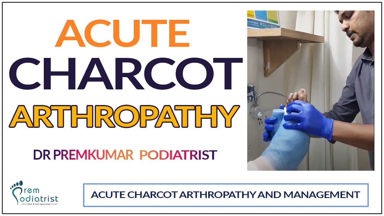 Charcot Arthropathy: Understanding and Managing Charcot Foot | Dr. Premkumar, Podiatrist