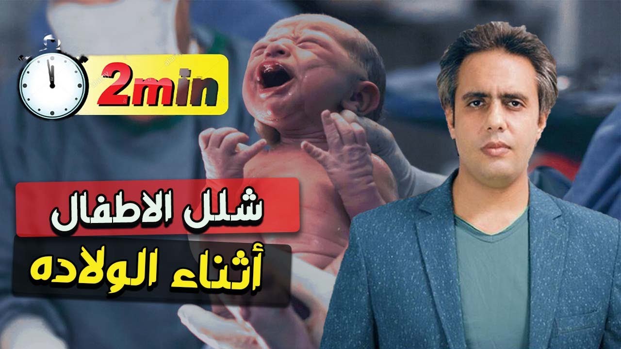 اعرف ايه هو الشلل الدماغى عند الاطفال وازاى بيحصل  (cerebral palsy)